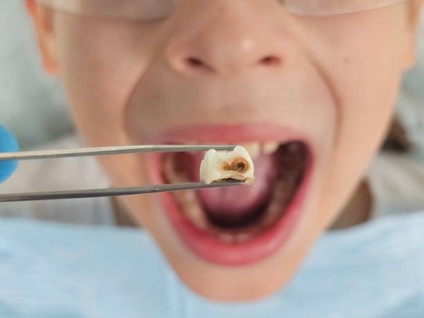 Best Emergency Treatment for Toothache in North Gates, NY